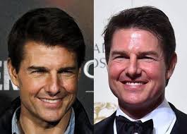 El nuevo rostro de Tom Cruise huele a cirugías estéticas