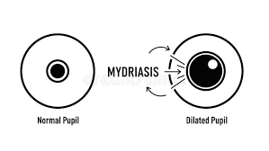 Image result for Mydriasis