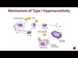 type i hypersensitivity ige mediated or immediate hypersensitivity youtube in 2021 hypersensitivity anaphylaxis type i