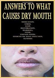 Answers To What Causes Dry Mouth Medication Stress Sleep Dehydration Diarrhea Fever Certain Foods Diabetes Or Yeast Infection Illnesses Tiatuns Dr Alex Zixera 9798672857602 Amazon Com Books