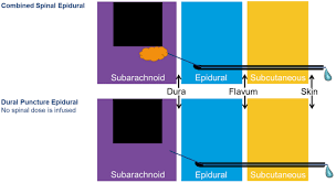Image result for Non-Pharmacologic Pain Control in Labor