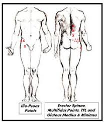 Image result for Trigger Point Location