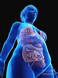 Related posts of women's internal organs of the body. Illustration Of An Obese Woman S Internal Organs Photograph By Sebastian Kaulitzki Science Photo Library