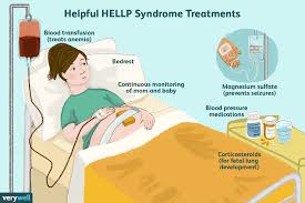 Hellp Syndrome Definition Symptoms Traits Causes Treatment