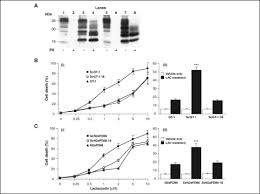 Frédéric von anhalt und zsa zsa gabor. Disease Related Prion Protein Forms Aggresomes In Neuronal Cells Leading To Caspase Activation And Apoptosis Journal Of Biological Chemistry