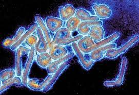 Marburg virus is one of 2 viruses belonging to the filovirus family. Vhgnip43g0m Rm
