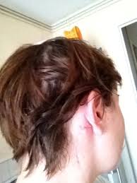 Bonjour, depuis deux mois j'ai une boule derrière la tête, près de l'oreille, là où s'arrêtent mes cheveux. Formation Tissulaire Ou Tumeur De La Parotide Help Troubles Orl Forum Sante Doctissimo