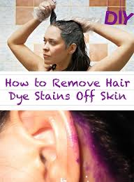 Anti dandruff shampoo with baking soda: How To Remove Hair Dye Stains Off Skin Red Hair Tips Hair Dye Removal Hair Hacks