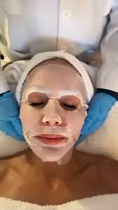 Taking it off #co2carboxytherapy