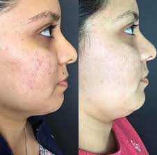 Affordable treatments, experienced professionals and results that last a . Before Afters Hi Beautiful Aesthet