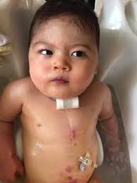 Help! My son has gotten a rash using the body wash in the all star resorts.  Is there anywhere