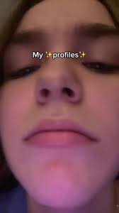 my face is underdeveloped