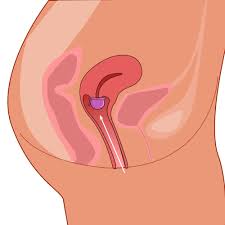 Image result for Cervical Cap