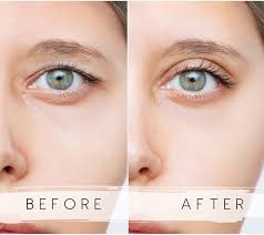 Adceftp Eyelid Tape, Assortment Pack (4Mm - 7Mm)480Pcs, Double Eyelid Tape, Droopy  Lids, Surgery-Free, Instant Eye Lift Tape Lifting, Suitable For Uneven Or  Monolids.Comfortable And Easy To Apply. : Amazon.Ca: Beauty &