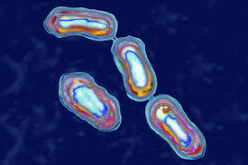 Bubonic plague refers to the painful lymph node swellings called buboes, primarily found around the base of the neck, in the armpits and groin which oozed pus and bled. California Confirms First Human Case Of The Plague In 5 Years What To Know