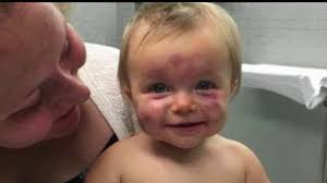 A WARNING FOR PARENTS: Mother Heeds Warning as Daycare Provider Starts  Business Again