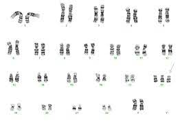 Chromosomenanalysen Allgemeine Informationen Dna Diagnostik Hamburg Gemeinschaftspraxis Fur Humangenetik Und Genetische Labore