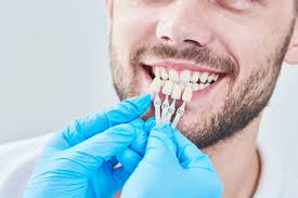 Dentistry and photography by @drgordonchee 👇. Cosmetic 380 Family Dentistry