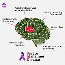 Beyond the obvious stress of being diagnosed and needing various treatments, you may experience physical changes you weren't. Severe Alzheimer Disease Template Postermywall