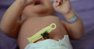 Anak kemungkinan menjadi gelisah dan panik. 5 Cara Memotong Tali Pusat Bayi Baru Lahir Popmama Com