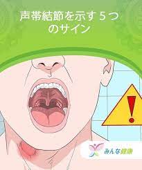 声帯結節を示す５つのサイン 結節 声帯 炎症