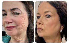 Has anyone tried the Effol regrowth serum? What's it like? Any reviews?