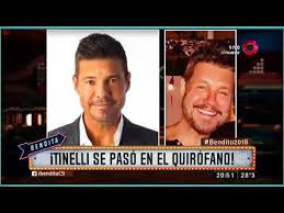 A lo largo de los años, candelaria tinelli protagonizó un increíble transformación en su apariencia, aparte de los tatuajes que cubrieron todo su cuerpo. Tinelli Se Paso Por El Quirofano Youtube