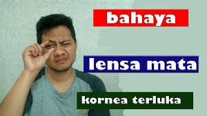Bahaya Lensa Mata Ulkus Kornea Di 2020 Lensa Youtube Mata