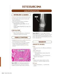 Malignant tumors can either be primary which is when they arise from the bone cells, or secondary, which is when a tumor developed somewhere else in the body, . Bone Tumors Osmosis