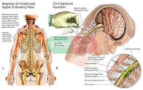 Pin On Health