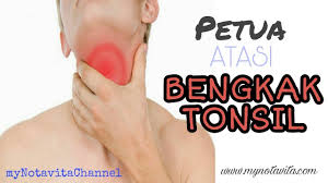 Daftar isicara merawat wajah berminyak1. Cara Mencegah Dan Merawat Batu Tonsil Blog Doktor 2021