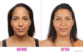 Forehead Reduction Surgery Is A Thing We Did It Blog Huda Beauty