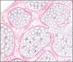 Schematic diagram for cross and longitudinal sections of long bone showing the compact bone formed from osteons that are consisted of circumferential bone lamellae around the haversian canals, and the cancellous or spongy bone that is formed from bone trabeculae arranged randomly. Jaypeedigital Ebook Reader