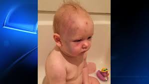 But as soon as i lay her down on her changing mat after the bath she starts screaming all the way through drying her, putting talc on her and while putting her baby grown on, right up until i pick her up. Justiceforjacob Arrest Made After Photos Of Bruised Baby Go Viral Katu