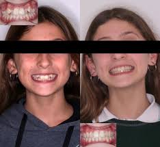 🌟 ¡Hola a todos! 🌟 Queremos presentarles al licenciado que nos acompaña  en el área de Psicología desde hace un tiempo. El es: 👨‍⚕️ **Licenciado  Mariano Pennisi** Estamos muy agradecidos por su