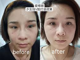 你可以不信面部风水! 但太阳穴一定不能凹! 从风水来说，夫妻宫饱满、 太阳穴饱满，旺夫又旺财😍 重点是你更好看更显年轻了！  ​10分钟恢复太阳穴凹陷问题​