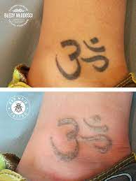 ( next to galvin' s off licence ) email: Blast From The Past Laser Tattoo Removal Publications Facebook