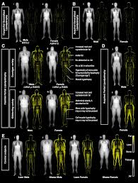 Brunzell jd, shankle sw, bethune je. Familial Partial Lipodystrophy Fpld Recent Insights Dmso