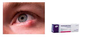 Hay Productos Para Tratar Orzuelos Sin Prescripcion Medica Blog