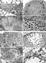 Viruses Special Issue Electron Microscopy In Virus Diagnostics And Research Find & download free graphic resources for virus. special issue electron microscopy