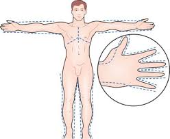 Escharotomy incision sites the dashed lines are the preferred escharotomy incision sites. Burns Thoracic Key