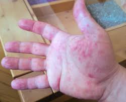 Die Diagnose Liegt Auf Der Hand Oder Springerlink