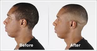 A skin fade is the style achieved by cutting the hair lower and lower as you move with the clipper towards the neck. Classic Bald Fade Wahlpro Com