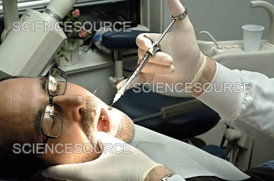 Novocaine Injection | Stock Image - Science Source Images