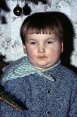 Перевод слова mumps, американское и британское произношение, транскрипция, словосочетания, однокоренные слова, примеры использования. Mumps Wikipedia