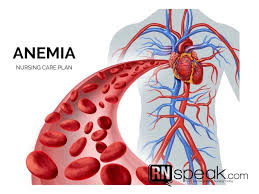 The medical management and nursing care are based on the classification of the anxiety. Anemia Nursing Care Plan Imbalanced Nutrition
