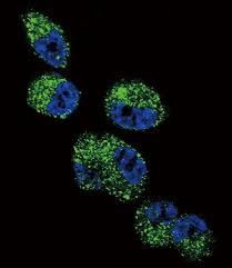 Igg elisa kit allows for the in vitro quantitative determination of igg concentrations in plasma, tissue homogenates and other biological fluids. Ct20 Antibody Search Results Mybiosource