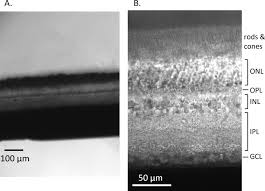 Maybe you would like to learn more about one of these? Recording Light Evoked Postsynaptic Responses In Neurons In Dark Adapted Mouse Retinal Slice Preparations Using Patch Clamp Techniques Protocol