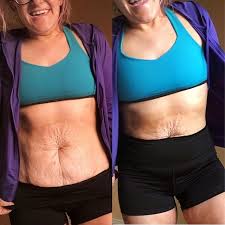 L O O S E S K I N It S A Thing No Matter What Socialmedia Perfection Tries To Say Or Make You Think Otherwise One Of The B I G G E S T Ques Extra Skin