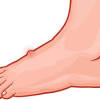 Skin cancer can hide as spot on sole melanoma on the extremities — nails, hands and feet — is the rarest subtype of the skin cancer, but it's also more aggressive. 1